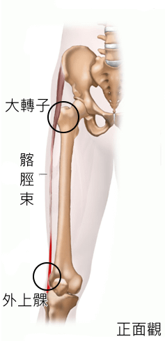 Ilitotibial-Band-Syndrome