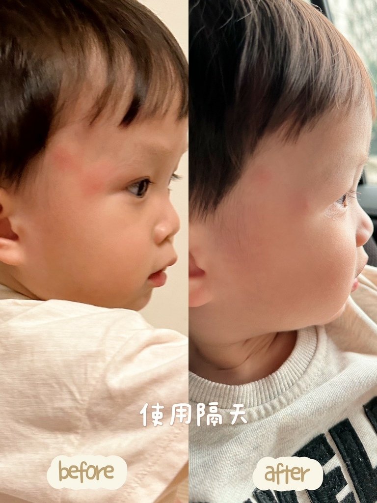 【好物分享】馨朵拉Cindora紫馨膏 媽媽包必備的萬用膏