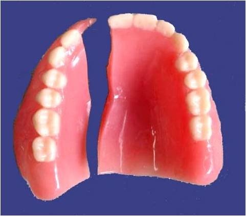 denture