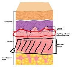 reticuar dermis 1