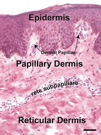 reticular dermis 2