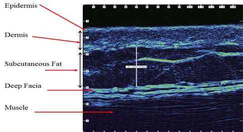 dermatology_skin_through_muscle01.jpg