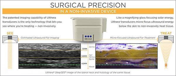 4_Key_Factors-Imaging.jpg