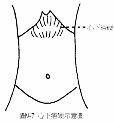胃3.gif