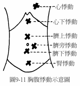 胃7.gif
