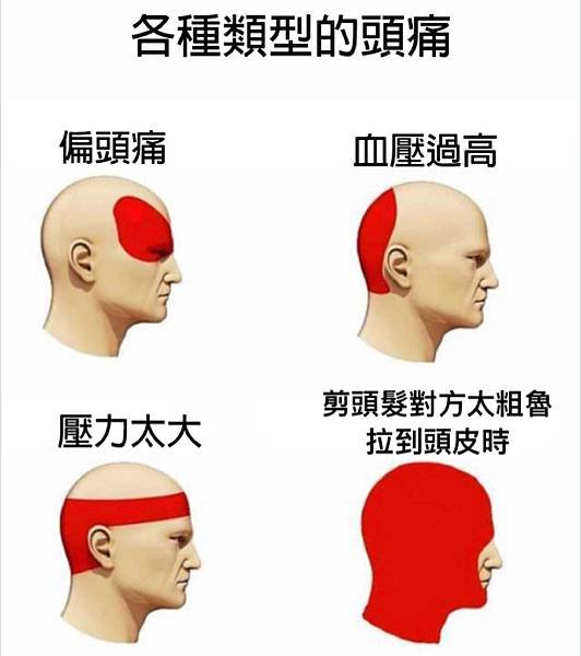 （迷因梗圖文）100元剪髮記-各類型的頭痛