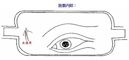 08-散翳內障：