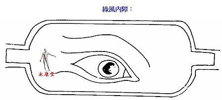 17-綠風內障：