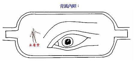 20-青風內障：