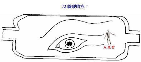 72-瞼硬睛疼：