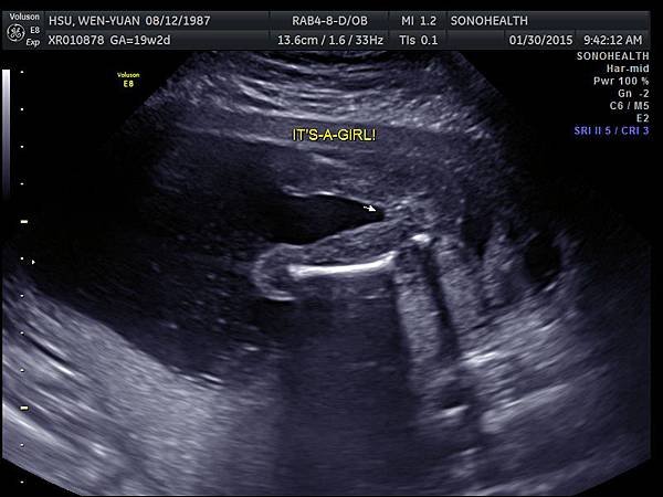 My baby sono!_8