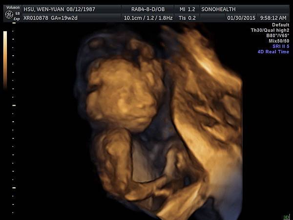 My baby sono!_25
