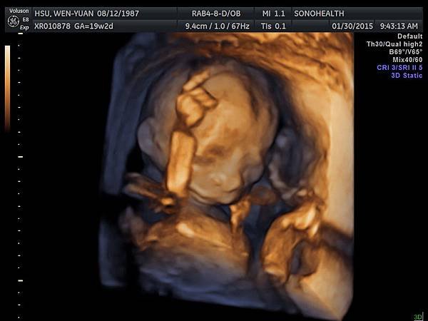 My baby sono!_10