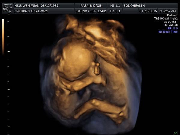 My baby sono!_14