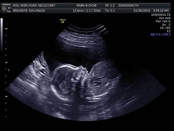 My baby sono!_1
