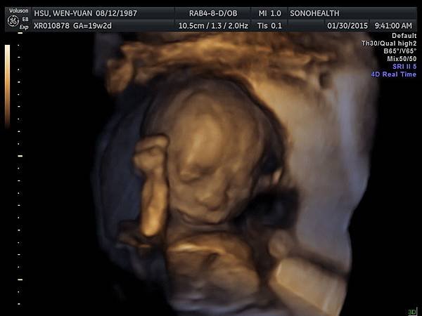 My baby sono!_5