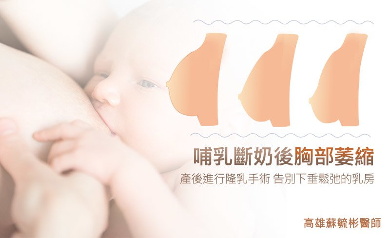 ［高雄隆乳］哺乳斷奶後胸部萎縮，產後進行隆乳手術，告別下垂鬆弛的乳房｜高雄蘇毓彬醫師.jpg