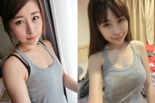 台北隆乳