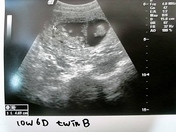 10W6D_B.JPG