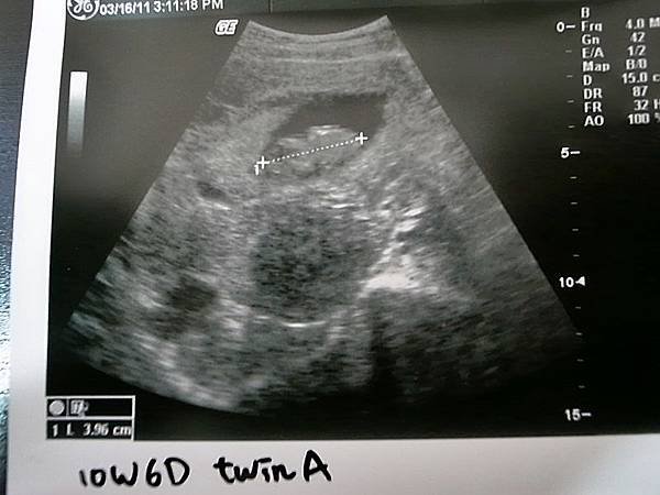 10W6D_A.JPG